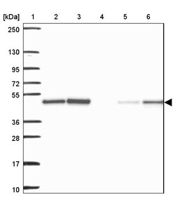 Invitrogen AGK Polyclonal Antibody 100 &mu;L | Buy Online | Invitrogen&trade; | Fisher Scientific