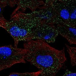 MANBA Polyclonal Antibody:Antibodies, Polyclonal