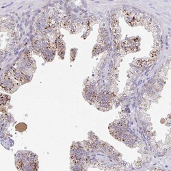 MANBA Polyclonal Antibody:Antibodies, Polyclonal
