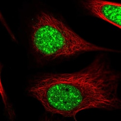 Invitrogen ZC3H14 Polyclonal Antibody 100 &mu;L; Unconjugated:Antibodies,