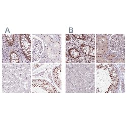 Invitrogen ZC3H14 Polyclonal Antibody 100 &mu;L; Unconjugated:Antibodies,