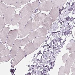 Invitrogen ZC3H14 Polyclonal Antibody 100 &mu;L; Unconjugated:Antibodies,