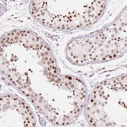 Invitrogen ZC3H14 Polyclonal Antibody 100 &mu;L; Unconjugated:Antibodies,