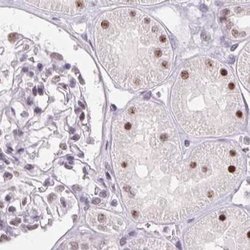 Invitrogen ZC3H14 Polyclonal Antibody 100 &mu;L; Unconjugated:Antibodies,