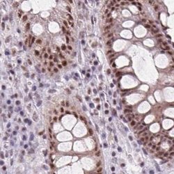 Invitrogen ZC3H14 Polyclonal Antibody 100 &mu;L; Unconjugated:Antibodies,