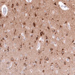 Invitrogen TTYH3 Polyclonal Antibody 100 &mu;L; Unconjugated:Antibodies,