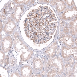 Invitrogen TTYH3 Polyclonal Antibody 100 &mu;L; Unconjugated:Antibodies,