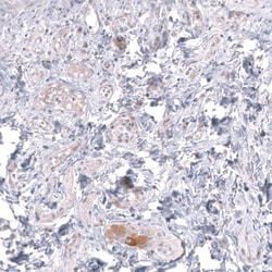 Invitrogen TTYH3 Polyclonal Antibody 100 &mu;L; Unconjugated:Antibodies,