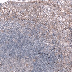 Invitrogen TTYH3 Polyclonal Antibody 100 &mu;L; Unconjugated:Antibodies,