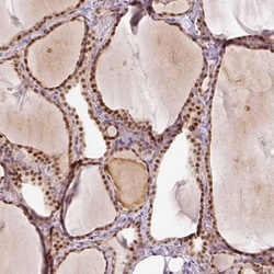 Invitrogen FAM179B Polyclonal Antibody 100 &mu;L; Unconjugated:Antibodies,