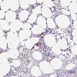 Invitrogen RNF212B Polyclonal Antibody 100 &mu;L; Unconjugated:Antibodies,