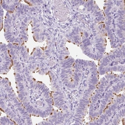 Invitrogen TMEM89 Polyclonal Antibody 100 &mu;L; Unconjugated:Antibodies,