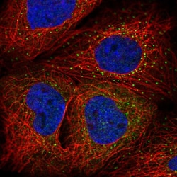 C10orf76 Polyclonal Antibody:Antibodies, Polyclonal