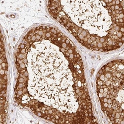 C10orf76 Polyclonal Antibody:Antibodies, Polyclonal