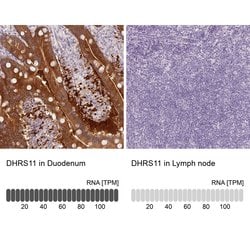 Invitrogen DHRS11 Polyclonal Antibody 100 &mu;L; Unconjugated:Antibodies,