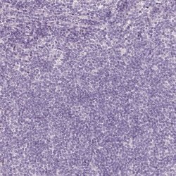 Invitrogen DHRS11 Polyclonal Antibody 100 &mu;L; Unconjugated:Antibodies,