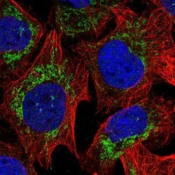Invitrogen RPLP2 Polyclonal Antibody 100 &mu;L; Unconjugated:Antibodies,