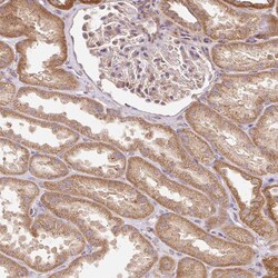 Invitrogen TRIAP1 Polyclonal Antibody 100 &mu;L | Buy Online | Invitrogen&trade; | Fisher Scientific