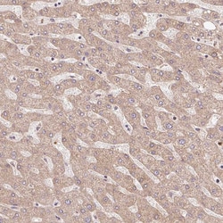 Invitrogen TRIAP1 Polyclonal Antibody 100 &mu;L | Buy Online | Invitrogen&trade; | Fisher Scientific