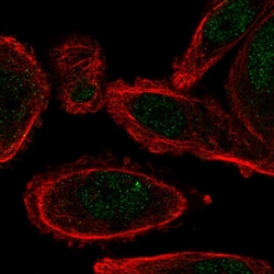 Invitrogen CYHR1 Polyclonal Antibody 100 &mu;L; Unconjugated:Antibodies,