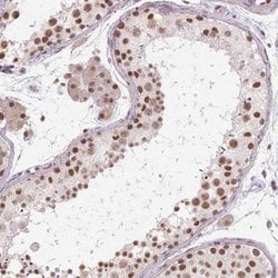 Invitrogen CYHR1 Polyclonal Antibody 100 &mu;L; Unconjugated:Antibodies,