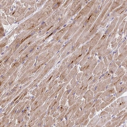Invitrogen MURF2 Polyclonal Antibody 100 &mu;L; Unconjugated:Antibodies,
