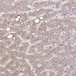 Invitrogen MURF2 Polyclonal Antibody 100 &mu;L; Unconjugated:Antibodies,