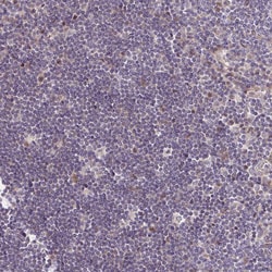 Invitrogen MURF2 Polyclonal Antibody 100 &mu;L; Unconjugated:Antibodies,