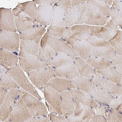 Invitrogen MURF2 Polyclonal Antibody 100 &mu;L; Unconjugated:Antibodies,