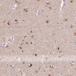 Invitrogen METTL13 Polyclonal Antibody 100 &mu;L; Unconjugated:Antibodies,