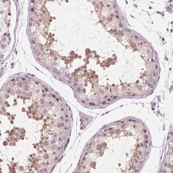 Invitrogen TDIF2 Polyclonal Antibody 100 &mu;L; Unconjugated:Antibodies,