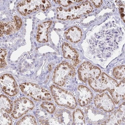 Invitrogen CCRN4L Polyclonal Antibody 100 &mu;L; Unconjugated:Antibodies,