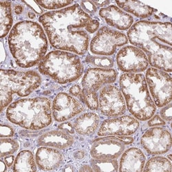 Invitrogen DLEU7 Polyclonal Antibody 100 &mu;L; Unconjugated:Antibodies,