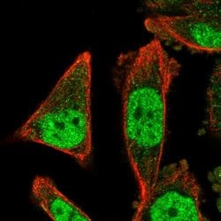 ZNF414 Polyclonal Antibody:Antibodies, Polyclonal