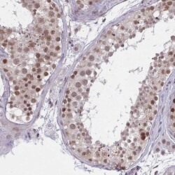 ZNF414 Polyclonal Antibody:Antibodies, Polyclonal