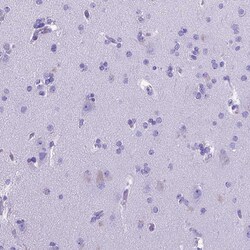 Invitrogen MEOX2 Polyclonal Antibody 100 &mu;L | Buy Online | Invitrogen&trade; | Fisher Scientific