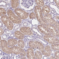 Invitrogen CTU1 Polyclonal Antibody 100 &mu;L; Unconjugated:Antibodies,
