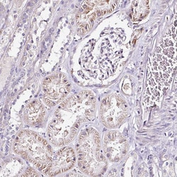 RPL10A Polyclonal Antibody:Antibodies, Polyclonal