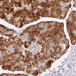 RPL10A Polyclonal Antibody:Antibodies, Polyclonal