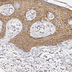 RPL10A Polyclonal Antibody:Antibodies, Polyclonal