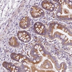 RPL10A Polyclonal Antibody:Antibodies, Polyclonal