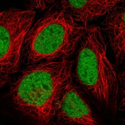 FUSIP1 Polyclonal Antibody:Antibodies, Polyclonal