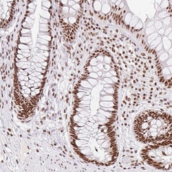 FUSIP1 Polyclonal Antibody:Antibodies, Polyclonal