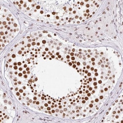 FUSIP1 Polyclonal Antibody:Antibodies, Polyclonal