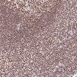 FUSIP1 Polyclonal Antibody:Antibodies, Polyclonal