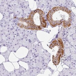 Invitrogen BSND Polyclonal Antibody 100 &mu;L; Unconjugated:Antibodies,