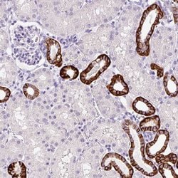 Invitrogen BSND Polyclonal Antibody 100 &mu;L; Unconjugated:Antibodies,