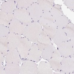 Invitrogen BSND Polyclonal Antibody 100 &mu;L; Unconjugated:Antibodies,