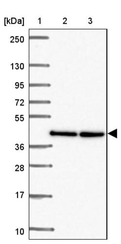 Invitrogen TWF2 Polyclonal Antibody 100 &mu;L; Unconjugated:Antibodies,