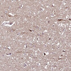 Invitrogen DPAGT1 Polyclonal Antibody 100 &mu;L; Unconjugated:Antibodies,